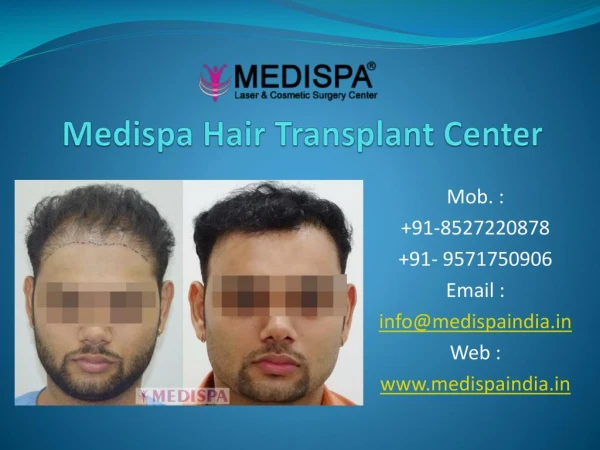 Best Hair Transplant Clinic In Jaipur