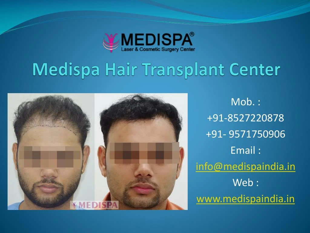 medispa hair transplant center