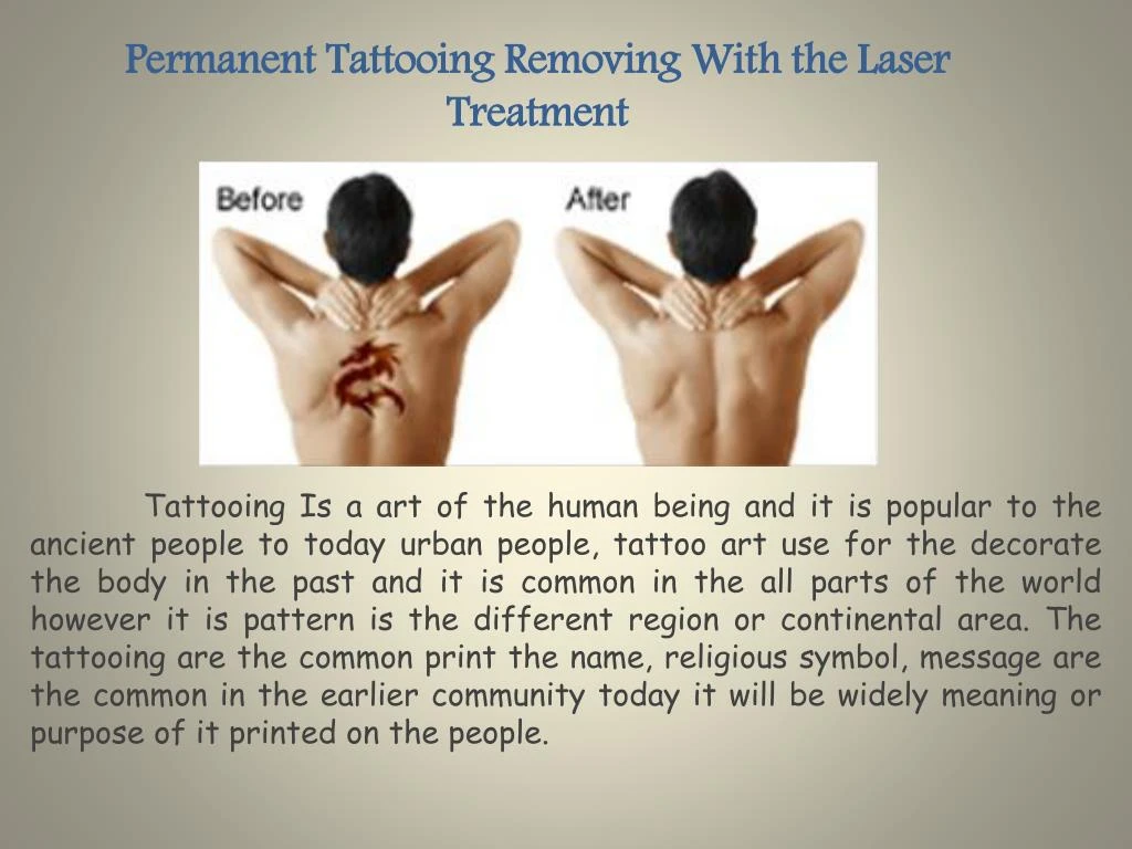 permanent tattooing removing with the laser treatment