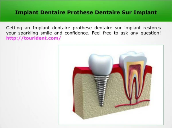Implant Dentaire Prothese Dentaire Sur Implant