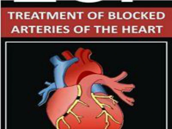 heart attack treatment-randhawahospital-heart failure treatment