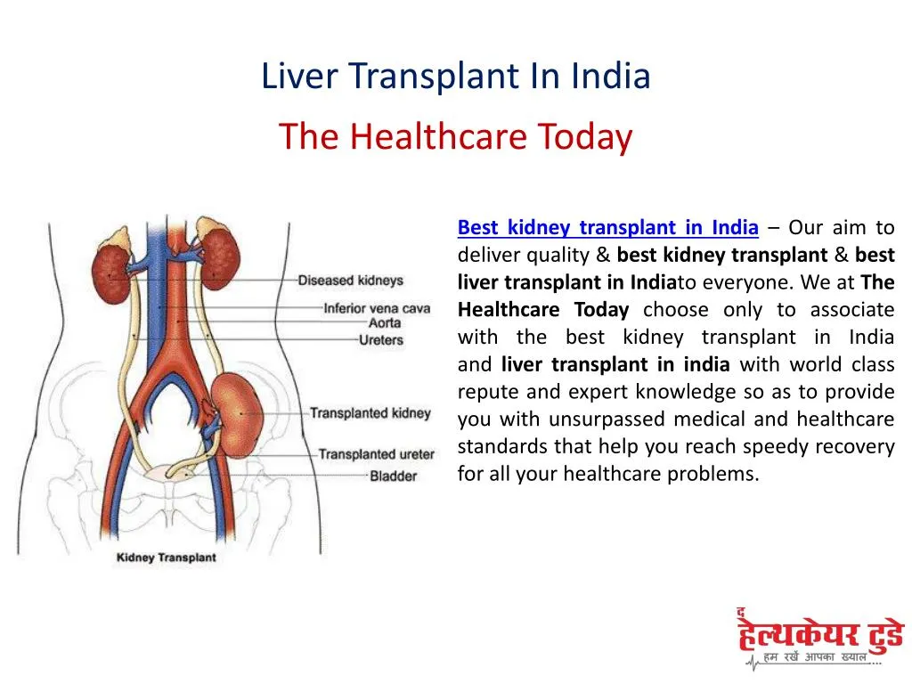 liver transplant in india