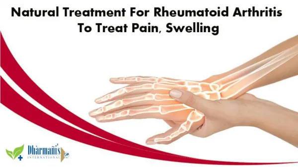 Natural Treatment for Rheumatoid Arthritis to Treat Pain, Swelling