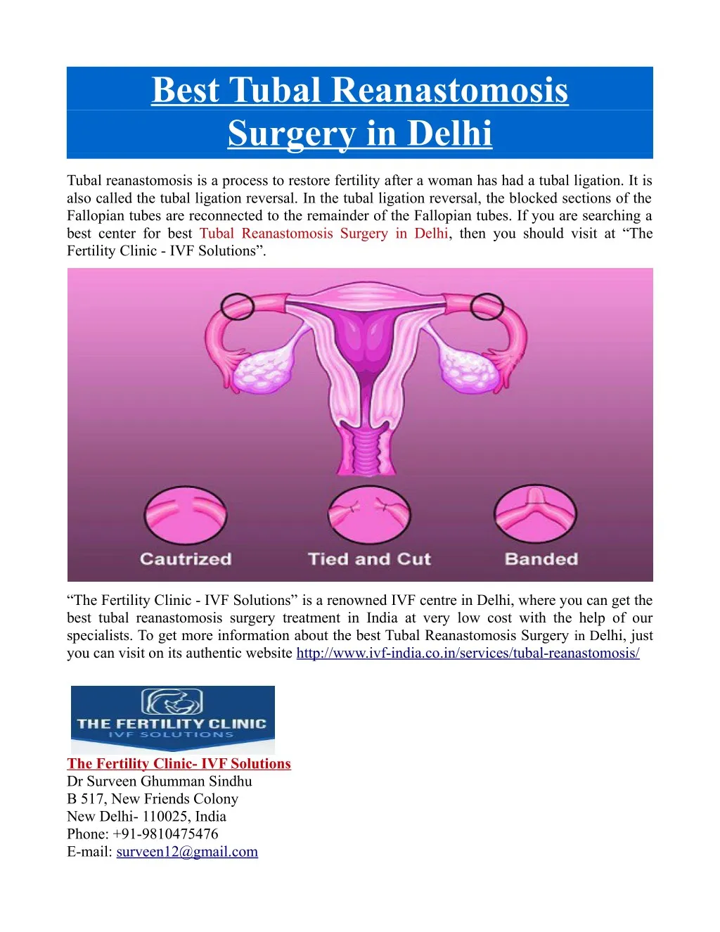 best tubal reanastomosis surgery in delhi