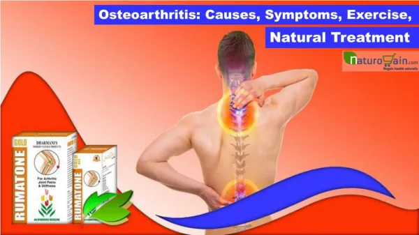 Osteoarthritis: Causes, Symptoms, Exercise, Natural Treatment