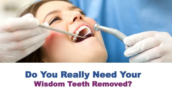 Do You Really Need Your Wisdom Teeth Removed?