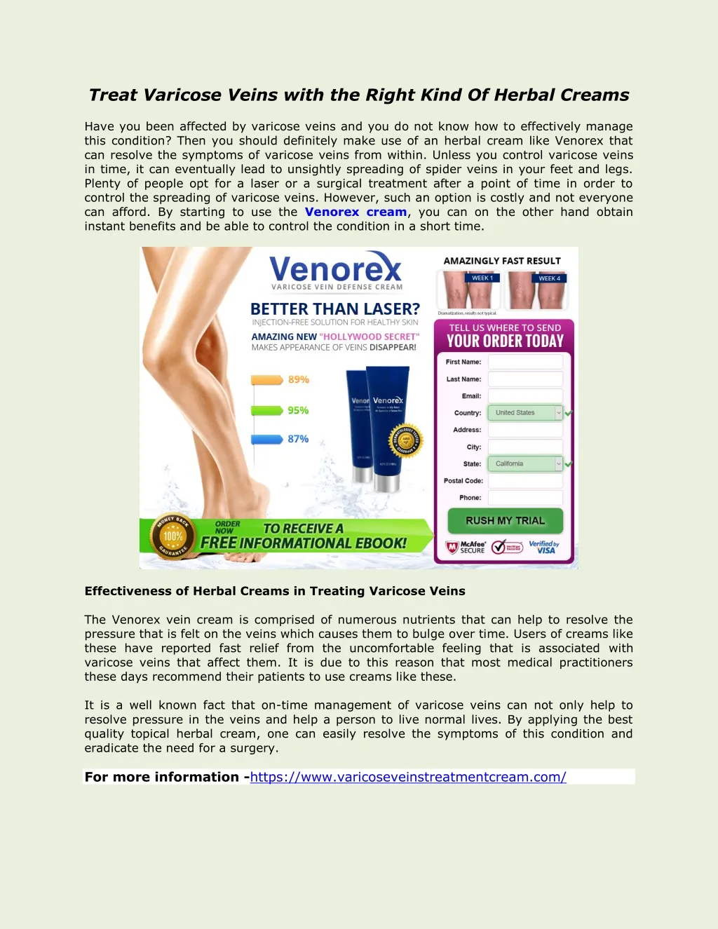 treat varicose veins with the right kind