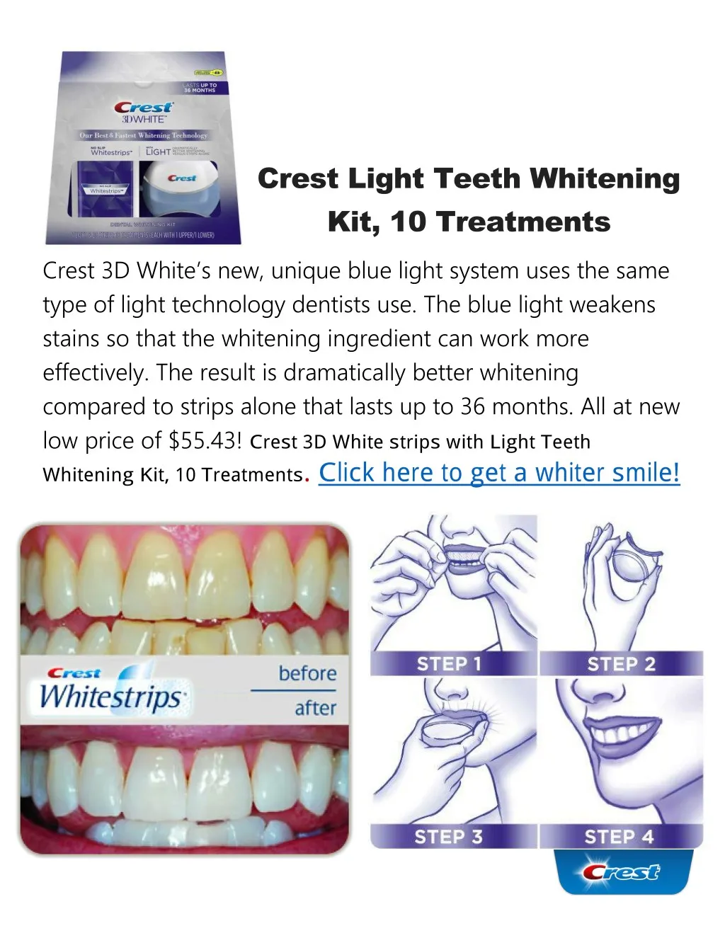 crest light teeth whitening kit 10 treatments