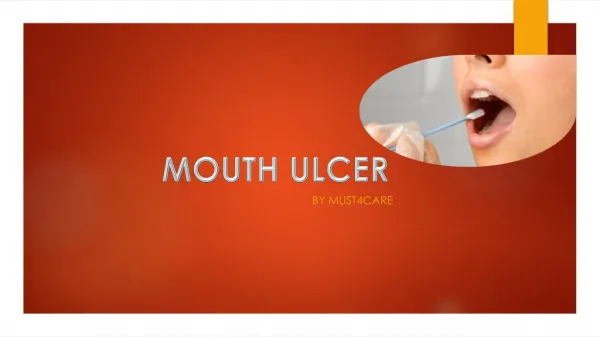 Treatment of Mouth Ulcer by Must4care