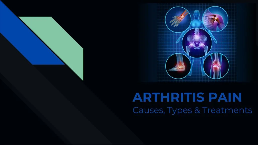 arthritis pain causes types treatments
