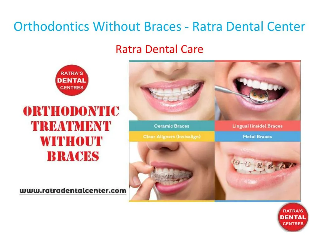orthodontics without braces ratra dental center