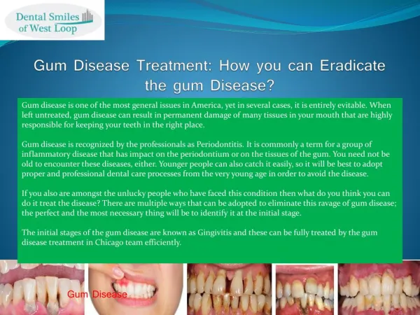 Gum Disease Treatment: How you can Eradicate the gum Disease?