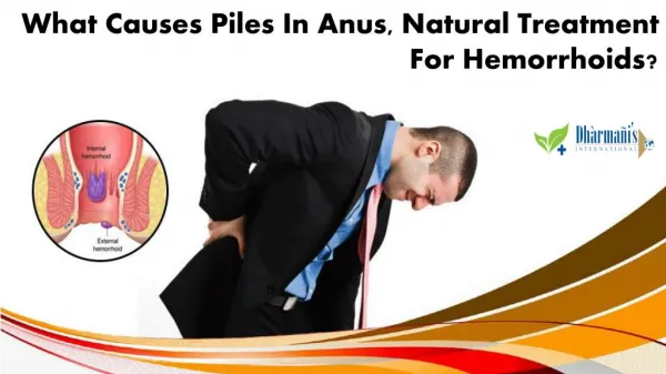 What Causes Piles in Anus, Natural Treatment for Hemorrhoids?