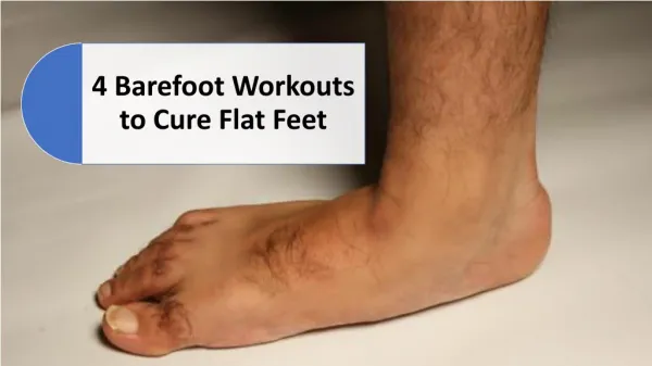 4 Barefoot Workouts to Cure Flat Feet