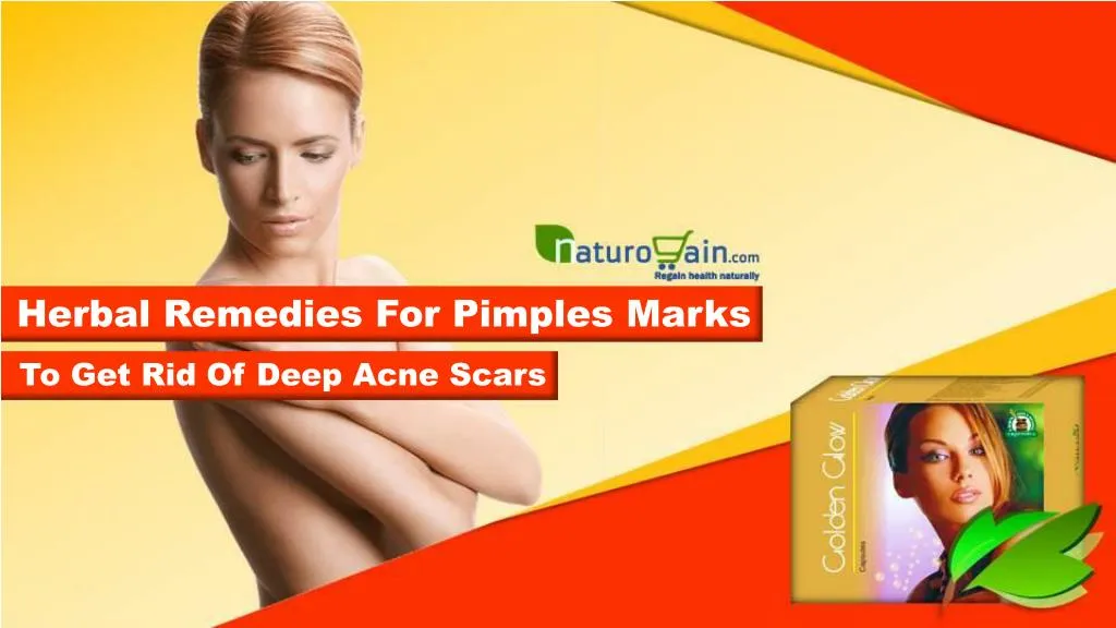 herbal remedies for pimples marks