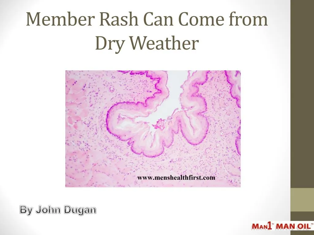 member rash can come from dry weather