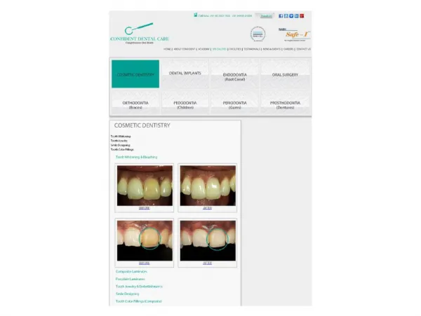 Best cosmetic dental clinic in Bangalore (confidentdentalcare.in)