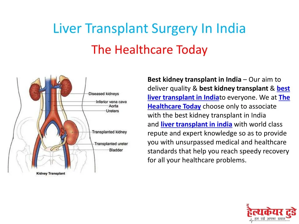 liver transplant surgery in india