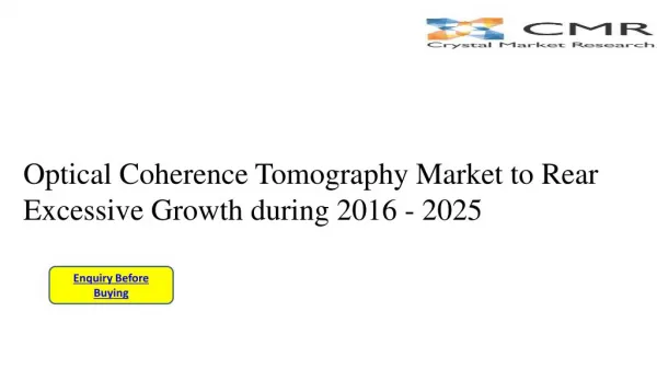 Optical Coherence Tomography Market- Analysis Including Size, Share, Market Key Trends & Industry Forecast 2016- 2025