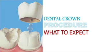 Dental Crown Procedure - What to Expect - slide 1