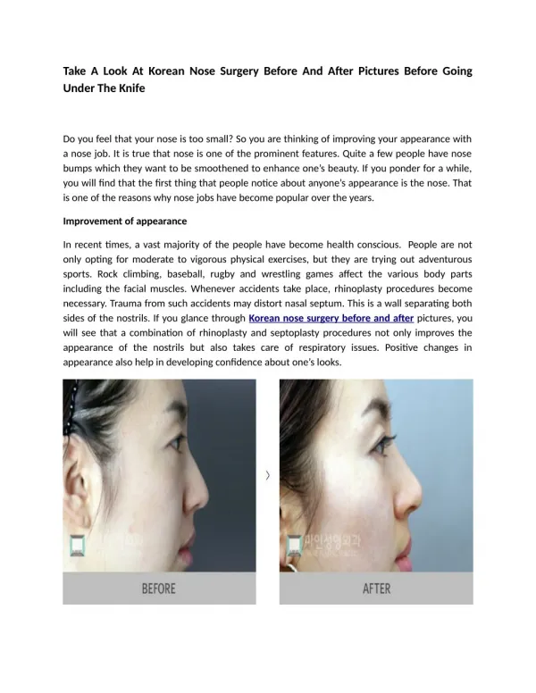 Take A Look At Korean Nose Surgery Before And After Pictures Before Going Under The Knife