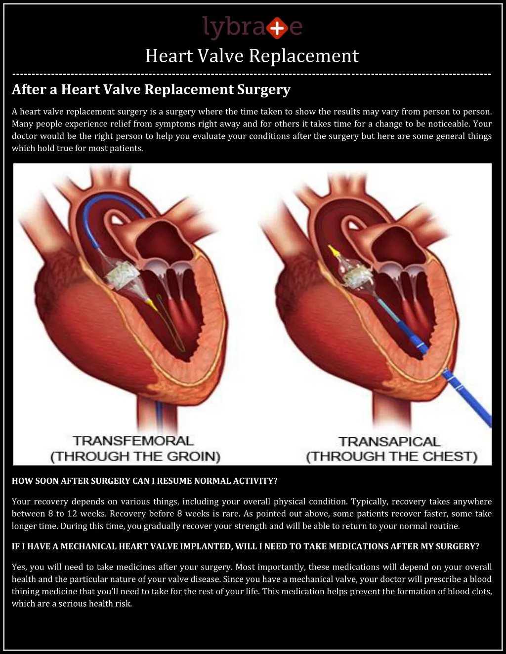 heart valve replacement