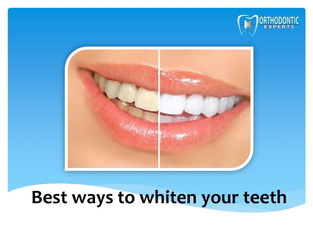 best ways to whiten your teeth