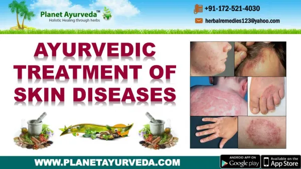 Ayurvedic Treatment of Skin Diseases - Types, Causes, Symptoms