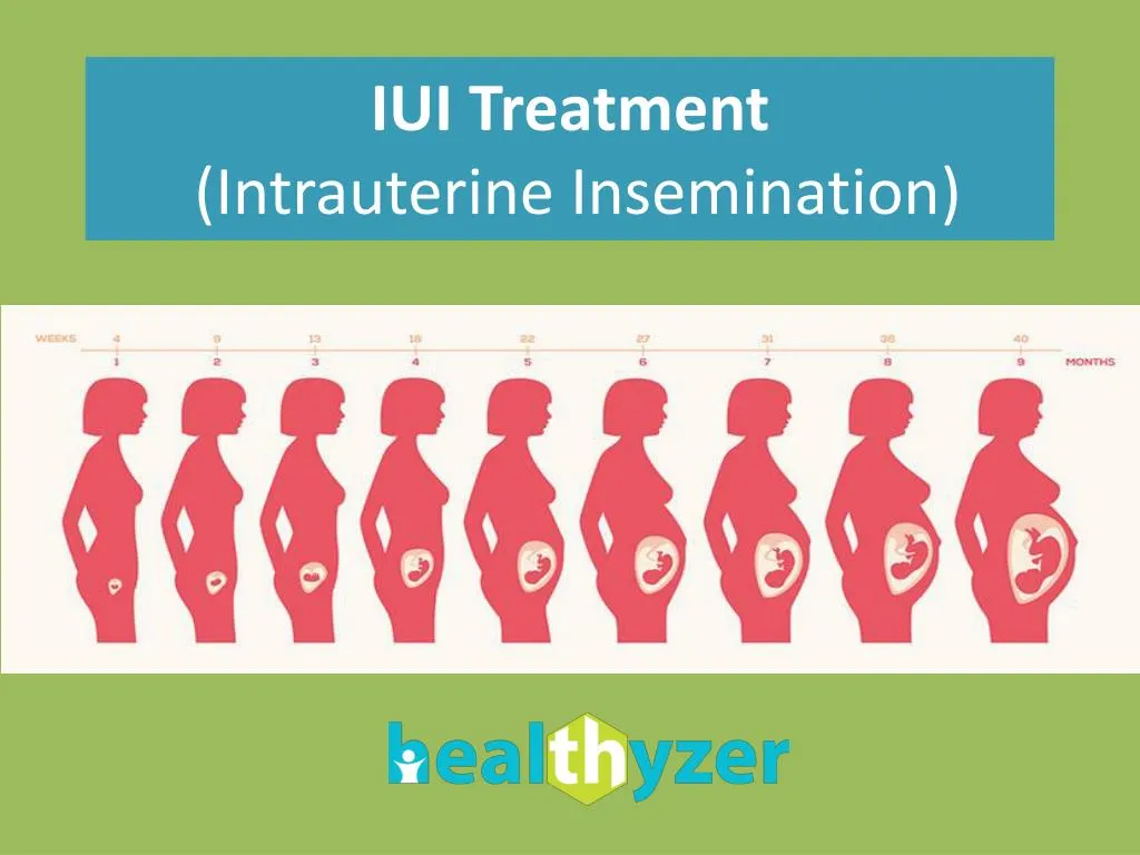 iui treatment intrauterine insemination