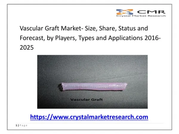 Vascular Graft Market: Industry Overview and Forecast 2025