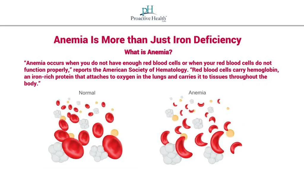anemia is more than just iron deficiency