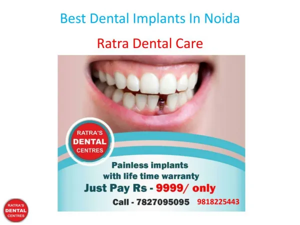 Best Dental Implants In Noida