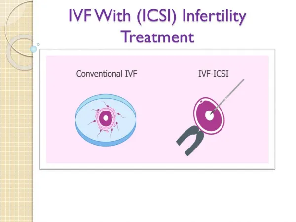 IVF With (ICSI) Infertility Treatment