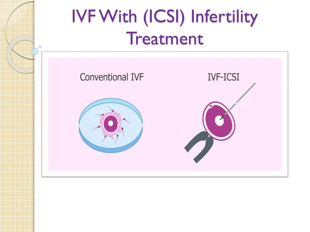 ivf with icsi infertility treatment