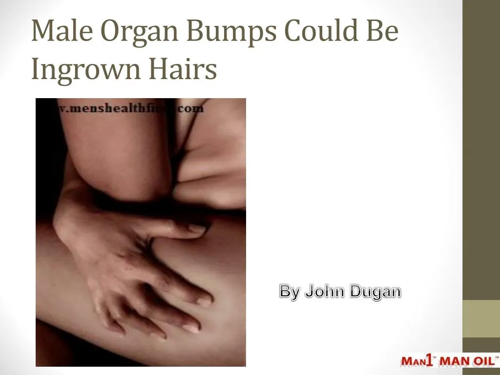 male organ bumps could be ingrown hairs