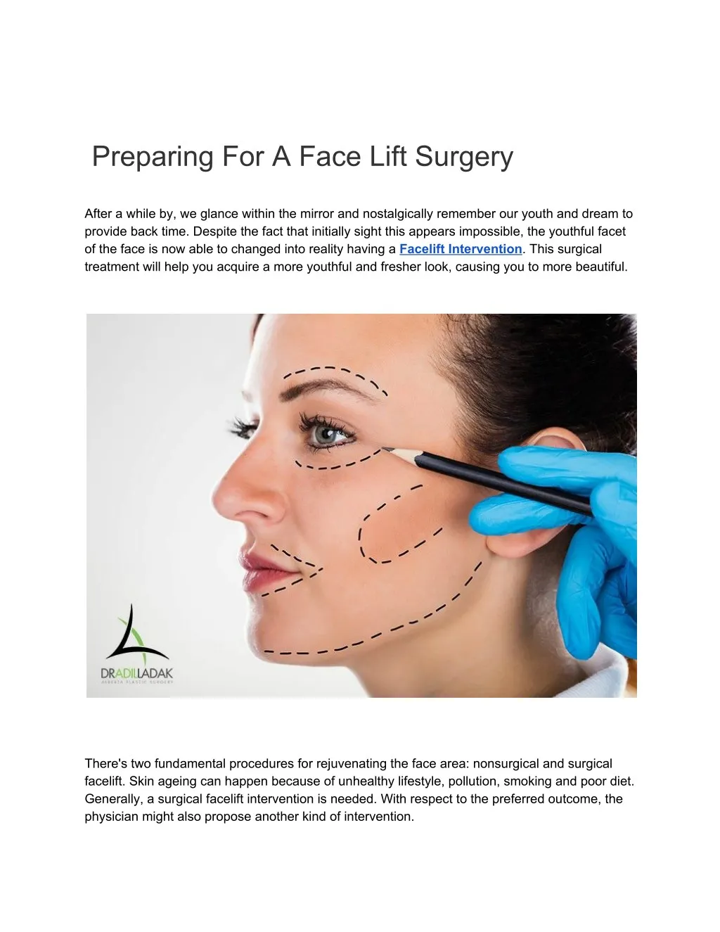 preparing for a face lift surgery