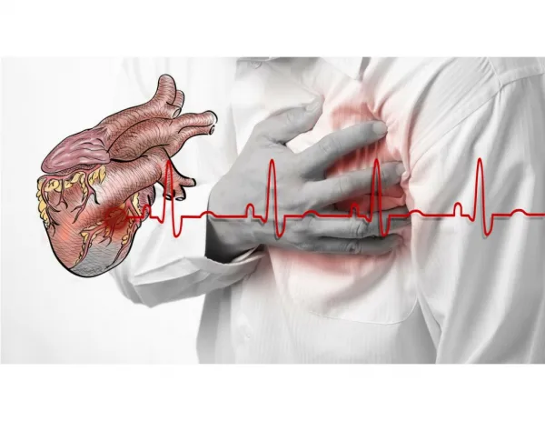 Heart Attack Symptoms Women, How To Stay Healthy, Heart Attack Warning Signs In Men, Heart Attack
