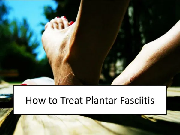 How to Treat Plantar Fasciitis