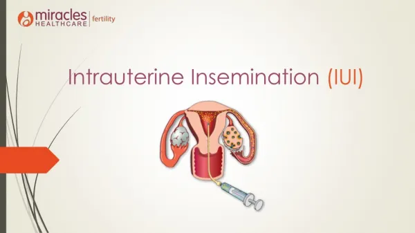 Intrauterine insemination (IUI) - IVF Procedure