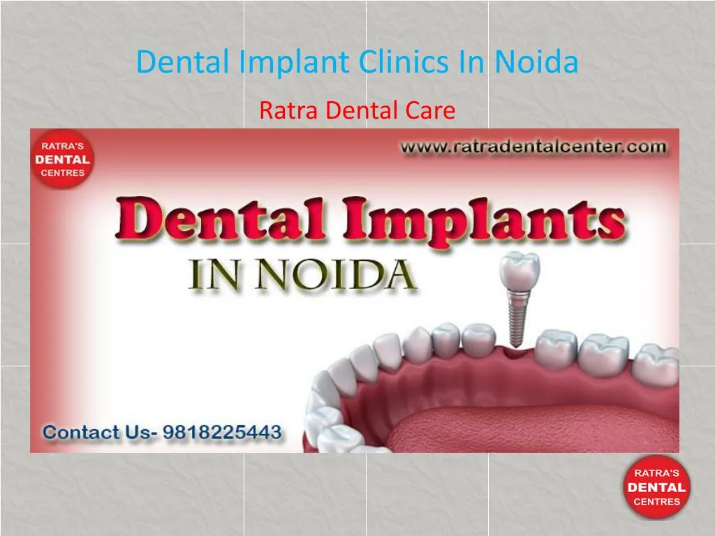 dental implant clinics in noida
