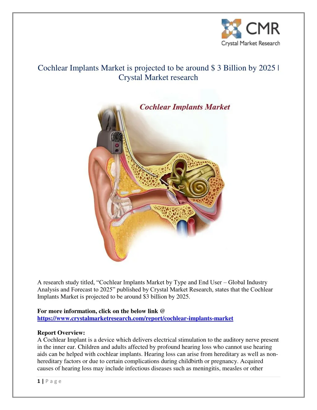 cochlear implants market is projected