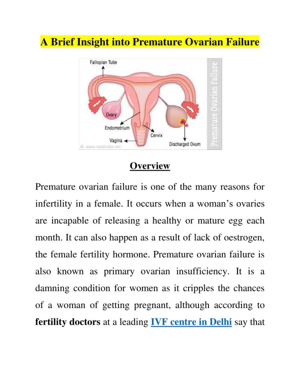 A Brief Insight into Premature Ovarian Failure