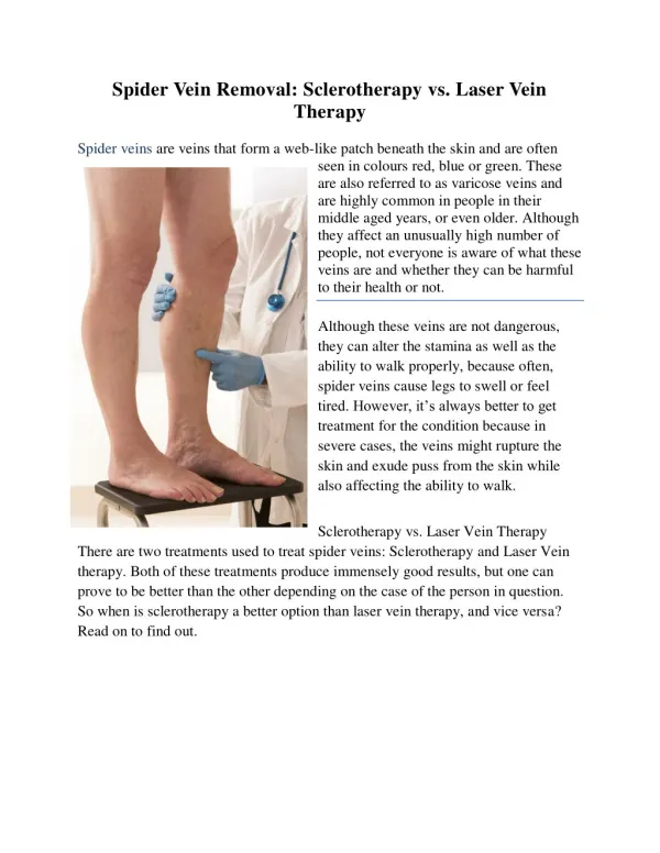 Spider Vein Removal: Sclerotherapy vs. Laser Vein Therapy