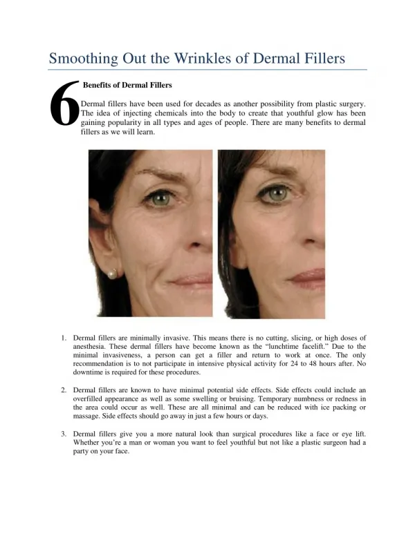 Smoothing Out the Wrinkles of Dermal Fillers