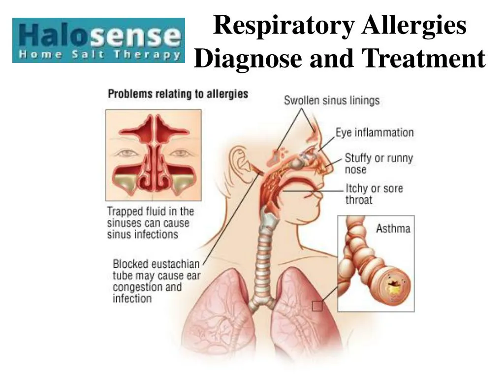 respiratory allergies diagnose and treatment