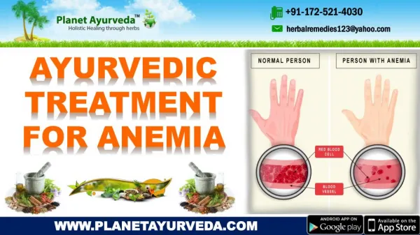 Ayurvedic Treatment for Anemia | Causes, Symptoms, Herbal Remedies & Diet