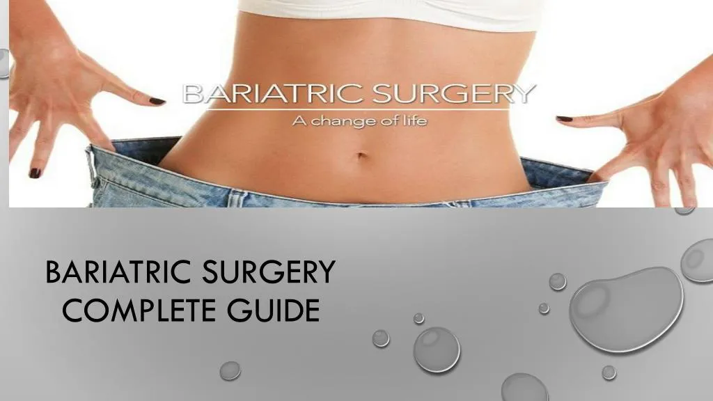 bariatric surgery complete guide