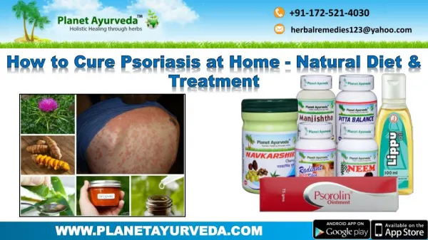How to Cure Psoriasis at Home? | Natural Diet & Ayurvedic Treatment