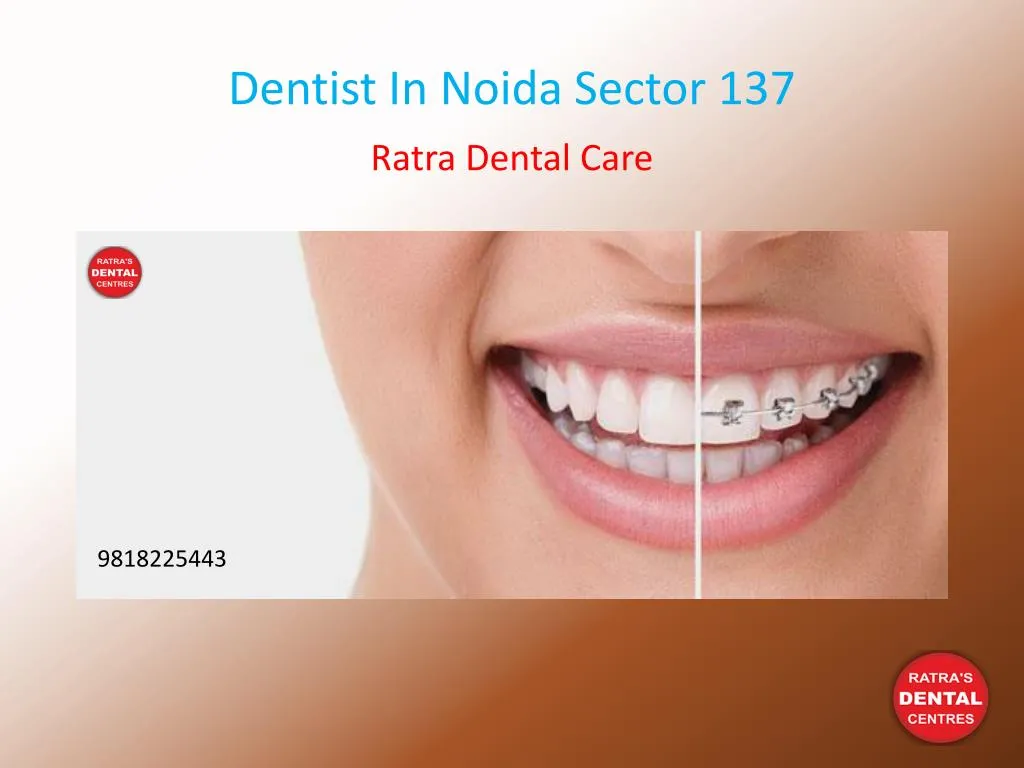 dentist in noida sector 137