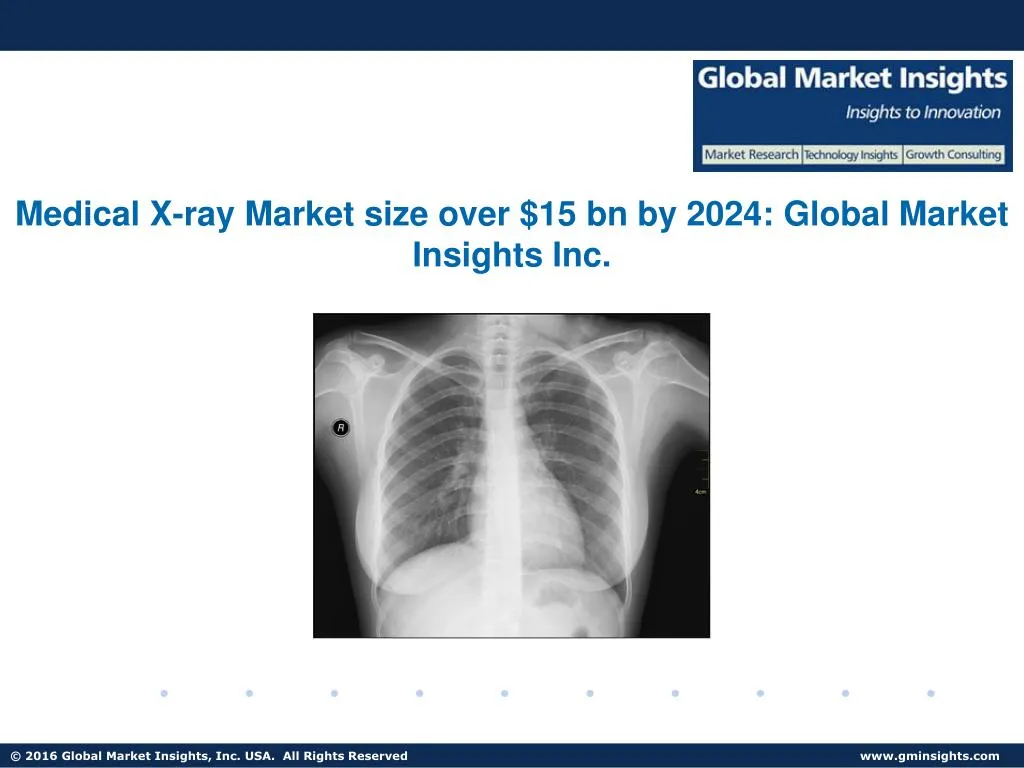 medical x ray market size over 15 bn by 2024